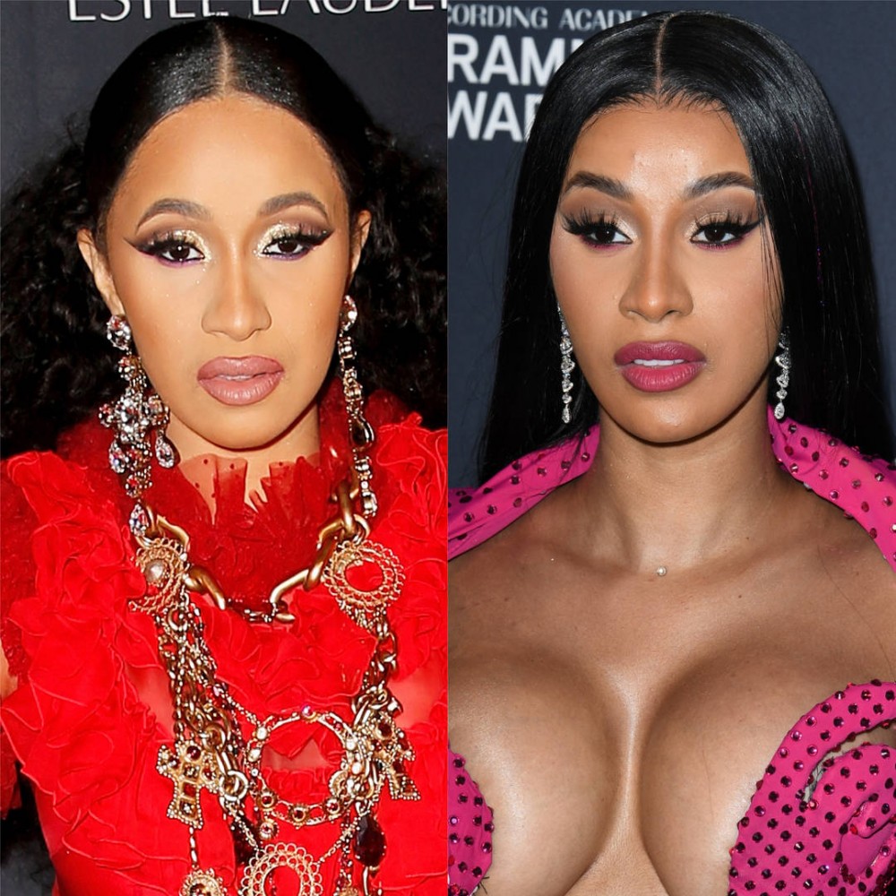 Cardi B Finally Unmasks & Fans Think She's Had Plastic Surgery