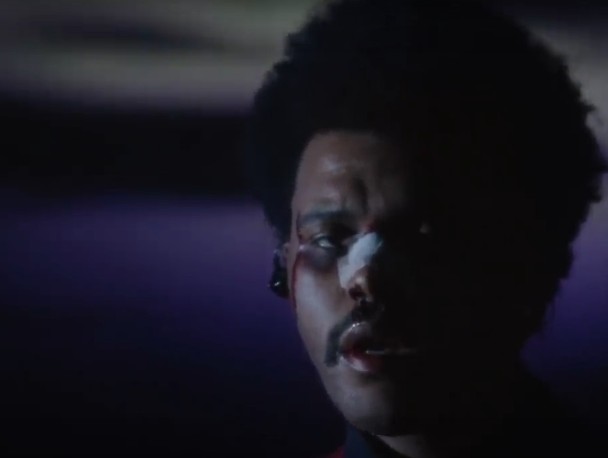 The Weeknd, Beaten Bloody, Sings "Blinding Lights" On 'Kimmel': Watch