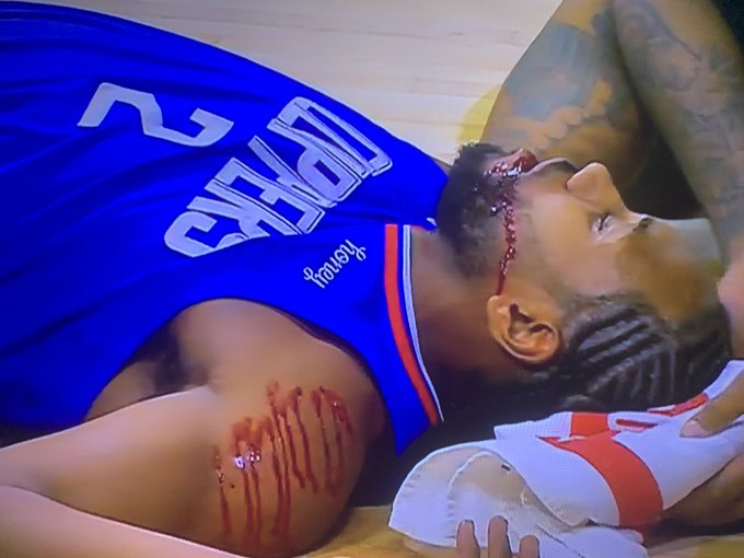 SOURCE SPORTS: Kawhi Leonard Receives 8 Stitches in Christmas Day Game