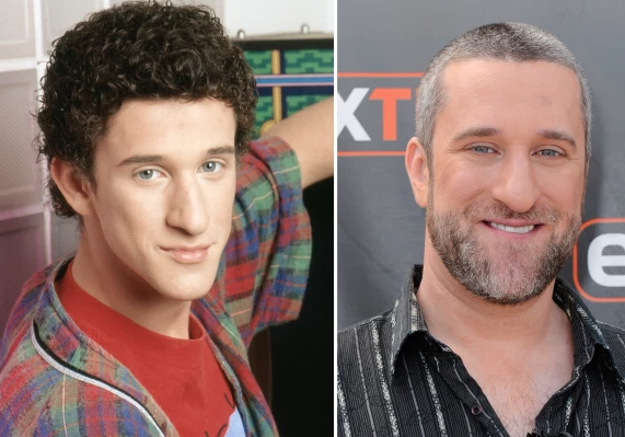 “Screech” From ‘Saved By The Bell’ Hospitalized Reportedly From Cancer