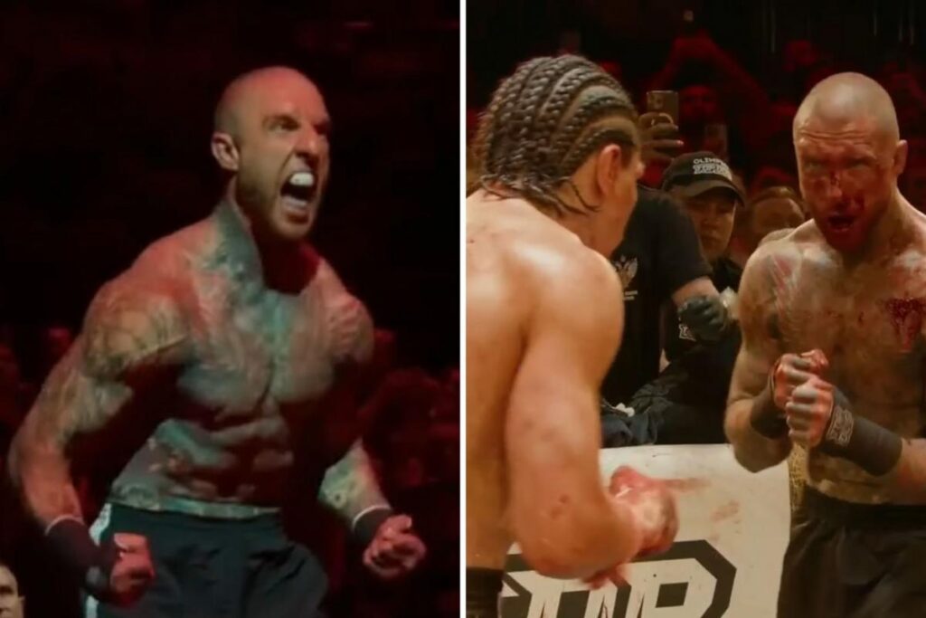 Alex Terrible Posts Bloody Aftermath of Latest Bare Knuckle Fight Alex Terrible Posts Bloody Aftermath of Latest Bare Knuckle Fight